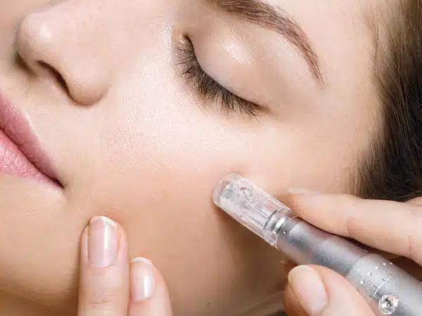 Utilizarea Microneedling-ului devine tot mai populară printre femei, în ciuda riscurilor semnificative