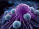 Modelul AI COMPASS prezice răspunsul la imunoterapia pentru cancer cu 8,5% mai bine
